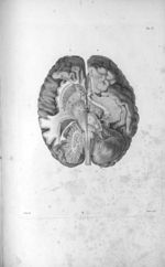 Pl. V. Représentation du cervelet et d'une partie de la base du cerveau - Anatomie et physiologie du [...]