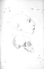 Pl. XX. Fig. 1 et 2. Tête et crâne d'une fille de vingt ans complètement imbécile - Anatomie et phys [...]