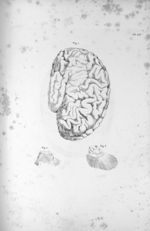 Pl. LII. Même cerveau, Pl. LI [Cerveau d'une jeune femme aliénée, dont la couche optique de l'hémisp [...]