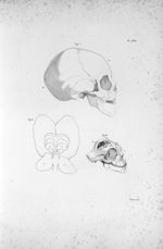 Pl. XVIII. Fig. II. Contour du cerveau d'un jeune homme complètement imbécile [...] ; crâne d'un enf [...]