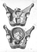 Tab. VI. [Première image : vue en coupe de l'utérus au second ou troisième mois de grossesse. Second [...]