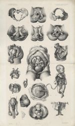 Planche 20. Périnée. Organes génitaux. Grossesse à terme. Foetus - [Anatomie élémentaire en 20 planc [...]