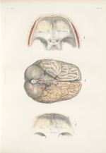 Planche 34 bis - Cas d'absence de la première paire de nerfs crâniens observé par M. Cl. Bernard - T [...]