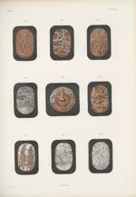 Planche 79 bis - Anatomie microscopique des membranes de l'oeil - Traité complet de l'anatomie de l' [...]