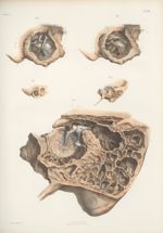 Planche 81 - Organe de l'ouïe - Oreille moyenne - Traité complet de l'anatomie de l'homme, par les D [...]