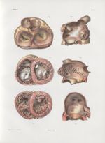 Planche 11 - Coupes des cavités du coeur - Traité complet de l'anatomie de l'homme, par les Drs Bour [...]