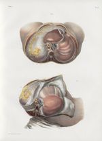 Planche 13 - Plan horizontal des viscères de la cavité abdominale - Zone sous-diaphragmatique - Trai [...]