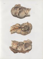 Planche 34 - Détails du gros intestin - Intestin coecum - Traité complet de l'anatomie de l'homme, p [...]