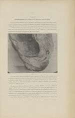 Fig. 3. [Partie inférieure de la tranche droite de la coupe juxta-médiane, vide du fœtus] - Étude an [...]