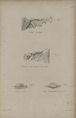 Pl. XV. - Fig. 1. - Trompe développée / Fig. 2. - Grossesse extra-utérine de la trompe / Fig. 3. - O [...]