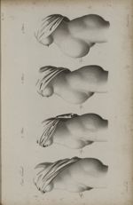 Pl. XXVI. - Histoire de la grossesse. Vue de profil. Fig. 1. - Etat naturel / Fig. 2. - 3 mois / Fig [...]