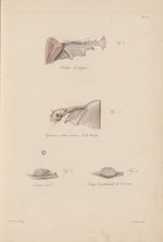 PL. XV. Fig. 1 - trompe développée / Fig. 2 - grossesse extra-utérine de la trompe / Fig. 3 - ovaire [...]