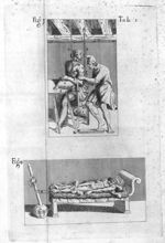 Tab. I. Fig. 1 Fig. 2 - In Hippocratis Coi medicorum omnium longe principis librum de Fracturis comm [...]