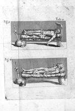 Tab. II. Fig. 1 Fig. 2 - In Hippocratis Coi medicorum omnium longe principis librum de Fracturis com [...]