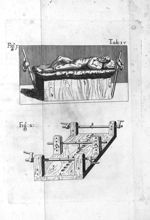 Tab. IV. Fig. 1 Fig. 2 - In Hippocratis Coi medicorum omnium longe principis librum de Fracturis com [...]