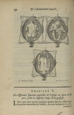 [Figures qui représentent les differentes situations naturelles de l'enfant dans la Matrice.] Fig. B [...]