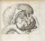 Pl. I. [Observations dur un foetus trouvé dans le mésentère d'un jeune homme de quatorze ans. Dissec [...]