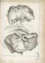 Pl. II. [Observations dur un foetus trouvé dans le mésentère d'un jeune homme de quatorze ans. Disse [...]