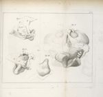 Pl. V. [Observations dur un foetus trouvé dans le mésentère d'un jeune homme de quatorze ans. Dissec [...]