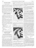 Figure 1. Tracé des incisions. Dissection du lambeau supérieur / Figure 2. Les lambeaux ont été reto [...]