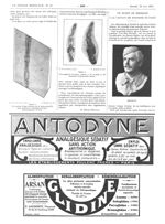 Figure 3. Une portion d'une mâchoire de la même préparée pour montrer les denticules de face / Figur [...]
