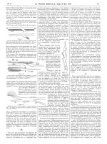 Figure 9. Névrome latéral du médian sur lequel s'implantent des fibres musculaires émanées du coraco [...]