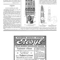 0514 - Page 514 - Société de médecine publique et de génie sanitaire [Georges Vitoux] / Variétés. Une main automatique pour mutilés