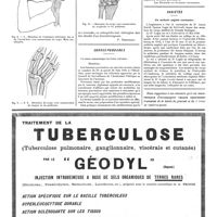 0893 - Page 896 - Orthopédie pratique. Les résultats éloignés des résections du poignet [P. Desfosses] / Correspondance / Variétés. Un médecin anglais centenaire