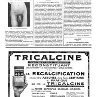 1087 - Page 1090 - Chirurgie pratique. Contribution à la chirurgie des vaisseaux [Celesia] / Correspondance. Le tremblement physiologique de l'iris [Bonnefon] / Variétés. Un office de renseignements à Luchon