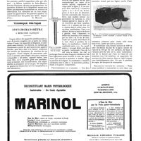 1158 - Page 1161 - La société médico-psychologique [R. Mallet] / Technique pratique. Sphygmomanomètre à mercure clinique