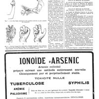 1375 - Page 1378 - Petite chirurgie pratique. La conservation dans les traumatismes de la main [P. Desfosses] / La médecine à travers le monde. Faculté de médecine de Bucarest