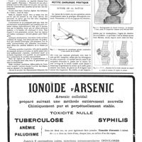 1519 - Page 1522 - Géographie médicale. La crise de la natalité au Congo belge / Petite chirurgie pratique. Suture de la rotule