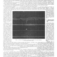1002 - Page 994 - Mouvement physiologique. La circulation artérielle du cerveau. I. Le pouls cérébral / II. Étude de l'anémie cérébrale expérimentale