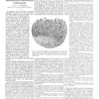 0055 - Page 51 - Travaux originaux. Travail du laboratoire d'anatomie pathologique de l'hôpital Evanghelismos d'Athènes (Professeur Jean Catsaras). Sur la pathogénie des hémorragies intestinales typhoïdiques. Par M. J. Catsaras...
