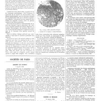 0122 - Page 118 - Travaux originaux. Une variété de neuralgie. La sympathalgie due à une tumeur glomique par MM. A. Ianichewski et M. Lebel  / Bibliographie / Sociétés de Paris. Académie des sciences. 9 janvier 1928 / Académie de médecine. 24 janvier 1928