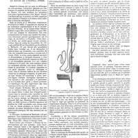 0171 - Page 165 - Mouvement chirurgical. L'anesthésie générale par voie veineuse au moyen de l'isopral-éther