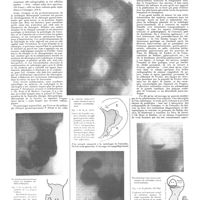 0214 - Page 208 - Variétés, informations. Livres nouveaux. Radiologie clinique du tube digestif publiée sous la direction de MM. Pierre Duval, J.-Ch. Roux, H. Béclère... I. Estomac et duodénum, par Pierre Duval, Jean-Charles Roux et Henri Béclère... [Ch. Lenormant] (Voir les nouvelles, p. 194)