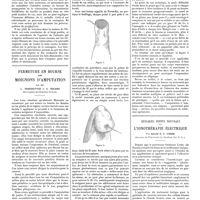 0379 - Page 373 - Travaux originaux. Tuberculose et héredité. Par Léon Bernard / Fermeture en bourse des moignons d'amputation. Par MM. L. Desgouttes... et A. Ricard... / Quelques points nouveaux de l'ionothérapie électrique. Par Harold H. U. Cross...