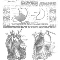 0407 - Page 401 - Travaux originaux. Traitement radical des ulcus gastriques haut situés. Par Victor Pauchet