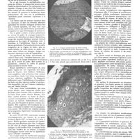 0572 - Page 566 - Travaux originaux. Contribution à l'étude du précancer. Par Ch. Dejean