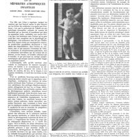0583 - Page 577 - Travaux originaux. Les altérations osseuses dans les néphrites atrophiques infantiles. Nanisme rénal - Pseudo-rachitisme rénal. Par E. Apert...
