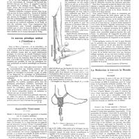 0691 - Page 685 - Chroniques, variétés et informations. Un voyage médical à Vichy / Un nouveau périodique médical «J'analyse» / Appareils nouveaux. Etrier à chaînettes pour les appareils à traction sur la membre inférieur / / La médecine à travers le monde. Belgique / Italie