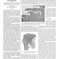 0775 - Page 769 - Travaux originaux. Mécanisme de production des hydarthroses et des arthrites traumatiques. Conception générale de leur traitement par R. Leriche...