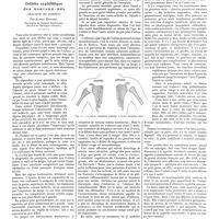 0801 - Page 795 - Petites cliniques de «la presse médicale». N° 38. Ostéite syphilitique des nouveau-nés (Maladie de parrot). Par Albert Mouchet...