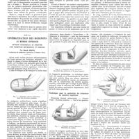 0817 - Page 811 - Travaux originaux. Vagabondage cellulaire. Par G. Durante / Sur la cinématisation des moignons au membre supérieur. Méthode personnelle de création d'un trimoteur antibrachial et brachial. Par Bosch Arana...