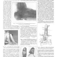 0822 - Page 816 - Chroniques, variétés et informations. Livres nouveaux. Les arthrites gonococciques, par H. Mondor... (Masson et Compagnie, éditeurs, 1928)... [J. Sénèque] / Plaies et maladies infectieuses des mains, par Mаrс Iselin... Préface de Ch. Lenormant... (Masson et Compagnie, éditeurs)... [P. Desfosses]