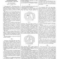 0933 - Page 923 - Petites cliniques de «la presse médicale». N° 42. Hydropneumothorax traumatique enkysté. Par Louis Ramond...