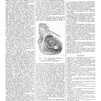 1201 - Page 1191 - Travaux originaux. Travail du service du professeur Vaquez à l'hôpital de la Pitié. Contribution à la pathogénie des souffles fonctionnels. Par L. Katsilabros... / Bibliographie