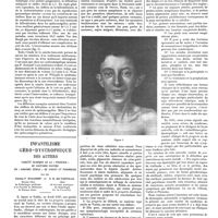 1231 - Page 1221 - Travaux originaux. Le syndrome humoral des splénomégalies primitives. Par MM. Benhamou, Gille et Jude / Infantilisme géro-dystrophique des auters. Variété clinique de la «progeria» de Hastings Gilford ou «nanisme sénile» de Variot et Pironneau. Par MM. Carlos P. Waldorp... et E. B. del Castillo