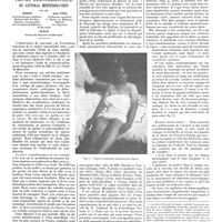 1387 - Page 1377 - Travaux originaux. Recherches nouvelles sur la fièvre exanthématique du littoral méditerranéen. Par MM. Boinet... ; Jean Piéri ; Dunan...